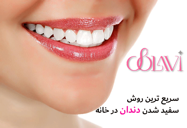 سریع ترین روش سفید شدن دندان در خانه